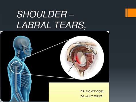 tests for labral tear shoulder|degenerative labral tear shoulder.